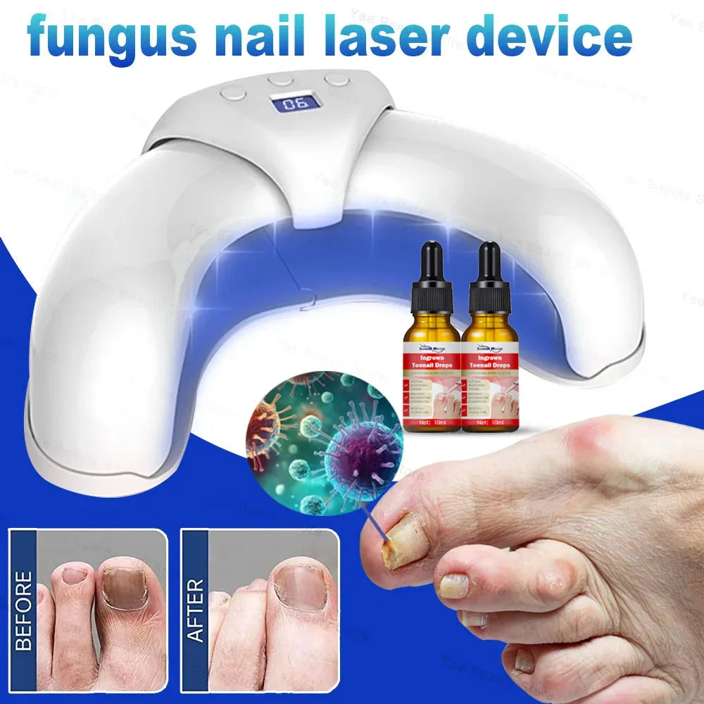 Fungal Nail Laser Device